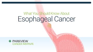 What You Should Know About Esophageal Cancer [upl. by Rebliw]