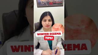 Winter Eczema Tips  Dry Skin Treatment  Flaky Patches on Skin [upl. by Enived]