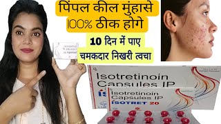 एक्ने पिंपल कभी नही होगा ये गोली खाओ isotretinoin capsules ip 20 mg  acne pimples treatment [upl. by Zetram]