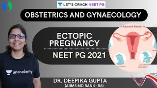 Ectopic pregnancy  NEET PG 2021  Dr Deepika Gupta [upl. by Uttica]