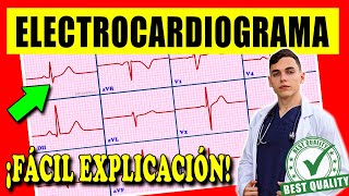 ELECTROCARDIOGRAMA Interpretación [upl. by Avictor]