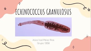 Echinococcus Granulosus Hidatidosis Unilocular [upl. by Alage151]