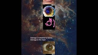 iridology samples [upl. by Sixele]