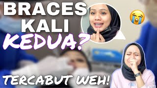 PAKAI BRACES KALI KEDUA TERCABUT DOH JANGAN PAKAI BRACES WEH 😭 [upl. by Winther35]