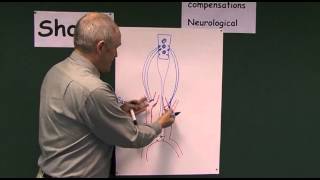 Shock 14 Neurological compensations in developing shock [upl. by Notxarb292]