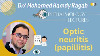 Neuro 2 Optic neuritis papillitis [upl. by Waldron922]