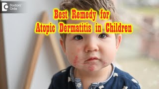 Pediatric Atopic Dermatitis  Can this progress to adult stage Dr Rasya Dixit  Doctors Circle [upl. by Anne]