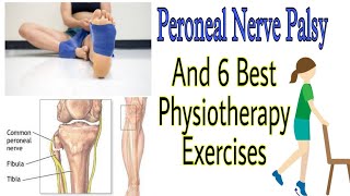 6 Best Common Peroneal Nerve Palsy And Physiotherapy Treatment geethamihi [upl. by Sibbie]