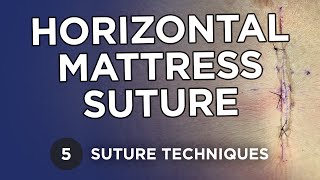 Horizontal Mattress Figure of 8 Half Buried Sutures  Learn Suture Techniques [upl. by Stroud]