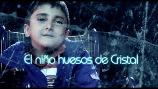 El niño huesos de cristal Testigo Directo HD [upl. by Mccourt]