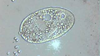 Egzocytoza  Exocytosis orzęsek [upl. by Nylecsoj]