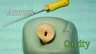 Access Cavity Preparation  Mandibular First Premolar [upl. by Saphra]