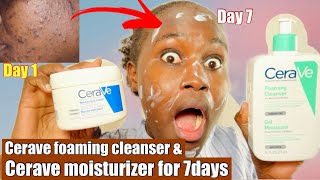 CeraVe Foaming Cleanser amp Moisturizing Cream Review Transform Your Skin in Just 7 Days [upl. by Eirruc666]