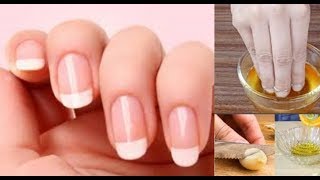 ASTUCE FAIRE POUSSER SES ONGLES PLUS VITE [upl. by Alisander]