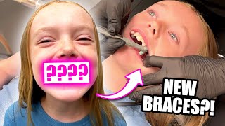 Kalia Gets Braces For The First Time SCARY [upl. by Barnaba]