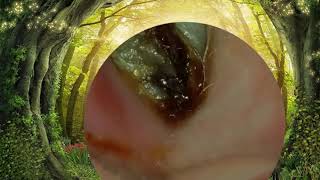 Biggest Ear Wax Difficult Removal Doctor [upl. by Rolat769]