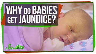 Why Do Newborn Babies Get Jaundice [upl. by Leunad995]