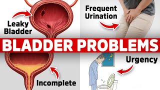 The 1 Vitamin Deficiency behind Bladder Issues Freq Urination Leaky Urgency [upl. by Ihana]