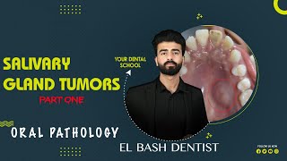 benign salivary gland tumors  oral pathology  عزت شومان [upl. by Nassah323]