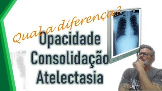 QUAL A DIFERENÇA OPACIDADE CONSOLIDAÇÃO E ATELECTASIA [upl. by Volotta206]