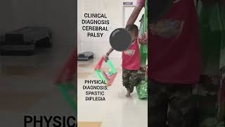 Physical DiagnosisSpastic Diplegic Cerebral Palsyparalysis physiotherapycerebralpalsy [upl. by Aleekat587]