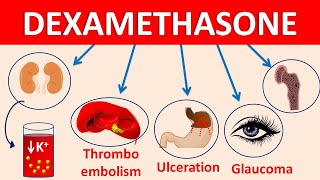 Dexamethasone tablets decadron  Mechanism side effects amp precautions [upl. by Ellevehc260]