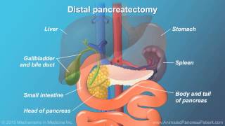 Pancreatic Surgery Benefits Risks and Relevant Anatomy [upl. by Nylsor404]