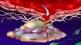 Introduction to Cancer Biology Part 4 Angiogenesis [upl. by Dielle168]