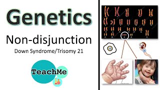 33  Trisomy 21 Down syndrome  NonDisjunction   IB Biology  TeachMe [upl. by Ardiedal]