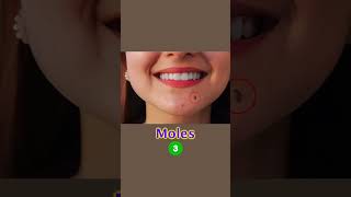 How to manage moles amp open pore Skin Care Tips  Dr Sarin [upl. by Yerbua959]