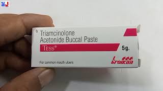 Tess Paste  Triamcinolone Acetonide Buccal paste  Tess Paste uses side effect benefit Review Hindi [upl. by Enneyehc]