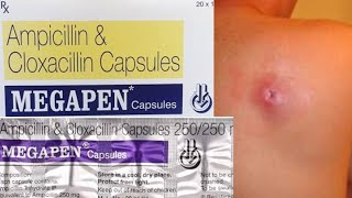 Megapen 500 mg capsules uses in telugu Ampicillin and cloxacillin uses in telugu [upl. by Aniratac]