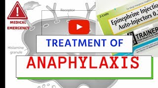 Treatment of Anaphylaxis  Medical Emergency  Must Know [upl. by Chance]