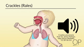 Respiratory Assessment by B Leary L DelSignore  OPENPediatrics [upl. by Kathlene736]