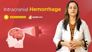 Intracranial Hemorrhage  Neurology Medicine Lectures  Medical Education  VLearning [upl. by Lahcar855]