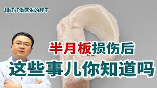 半月板损伤，您需要了解哪些医疗知识呢？运动医学医生给您说清楚 [upl. by Jordans]