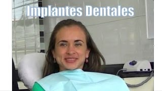 Testimonio de jovencita con Implantes Dentales frontales  Odontologia Estetica en Bogota [upl. by Eaneg]