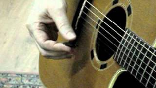 6Guitarist and hand dystonia difficulty holding the plectrum [upl. by Rowan]