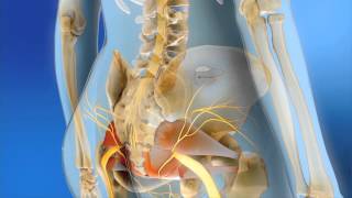 Sacral Neuromodulation  MOA Animation [upl. by Ferreby]