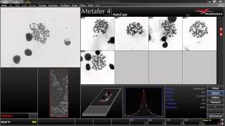 AutoCapt  Automated Image Acquisition with Metafer [upl. by Kcinnay65]