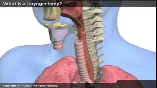 A0001a en A patient´s Guide to Total Laryngectomy Part 1 What is a Laryngectomy [upl. by Cioffred674]