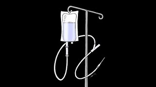 Hyperglycemic Hyperosmolar State  HHS [upl. by Violet]