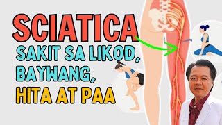 Sciatica Sakit sa Likod Baywang Hita at Paa  By Doc Willie Ong at Doc Liza Ong [upl. by Kerry235]