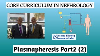 Plasmapheresis Part2 2 DrOssama Elkholy [upl. by Sane]