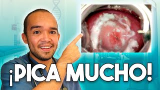 Cómo quitar el FLUJO GRUMOSO que PICA  CANDIDIASIS [upl. by Razatlab588]