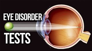 EYE DISORDER  Myopic Hyperopia Astigmatism TEST [upl. by Oniotna]