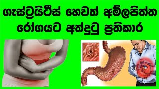 ලාබම ගැස්ට්‍රයිටීස් බෙහෙත  Gastritis in 5 minutes  How to get rid of gastritis completely [upl. by Aznarepse]