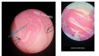 Histology Slides 1st year MBBS l Vascular System l Slides Identification points l SKZMDC Lahore [upl. by Uhthna]