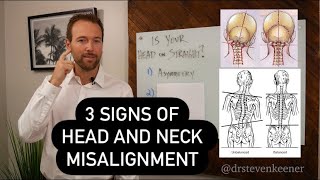 3 Signs of Head and Neck Misalignment  Dr K’s Sunday Special [upl. by Thanos]