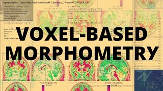 Voxelbased Morphometry VBM [upl. by Christiane541]